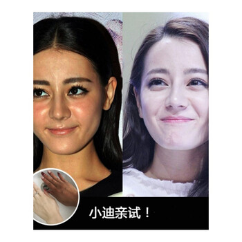 【皮肤晒黑,天生黑,暗黄】脖子手臂腿脸部