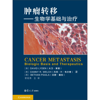 תƣѧ [Cancer Metastasis Biologic Basis and Therapeutics]