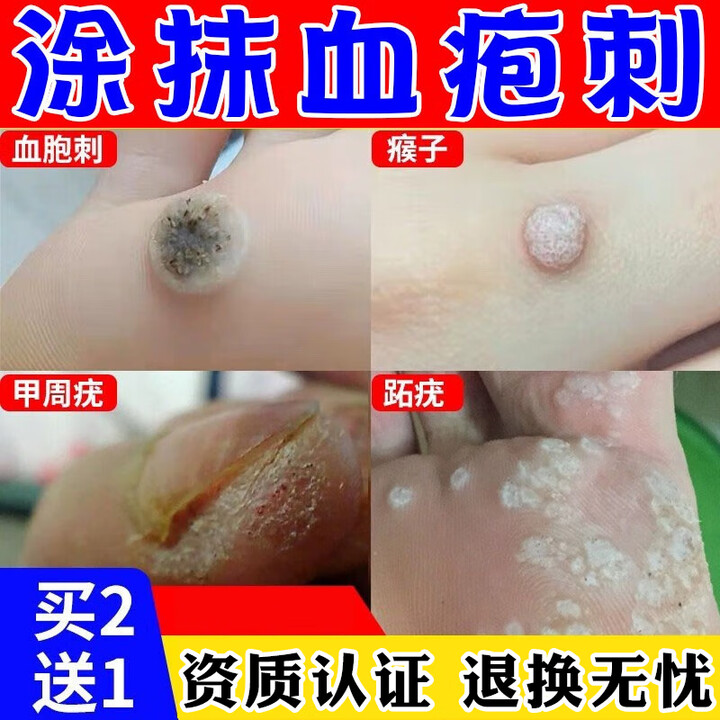 许善堂治用疗血胞刺的药跖疣去除膏血泡刺贴脚底甲周疣专用手脚上长硬疙 单盒体验装【图片 价格 品牌 报价】-京东