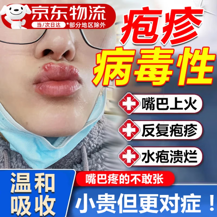 缇藏堂嘴唇疱疹嘴角嘴巴特药上火起泡药膏外用烂口角周皮炎专用脓疮溃烂 特效嘴唇上火起泡膏嘴巴疱疹【图片 价格 品牌 报价】-京东