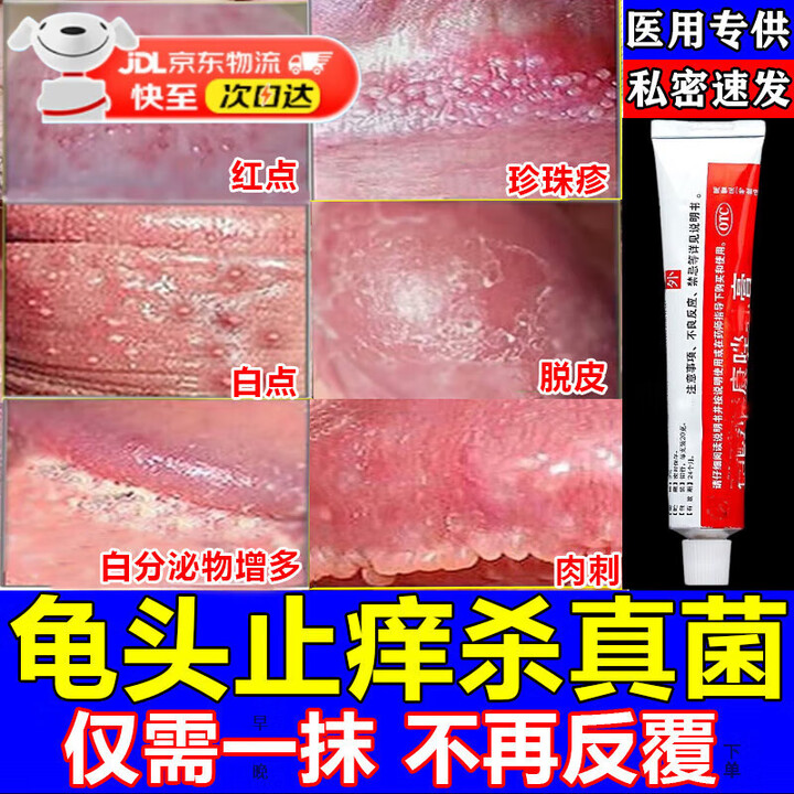 龟头炎药真菌感染 念珠菌 霉菌瘙痒包皮炎男性私处止痒药膏真菌感染糜烂皮肤用药硝酸咪康唑乳膏 5盒反复包皮龟头跟源型告别男言【图片 价格 品牌 ...