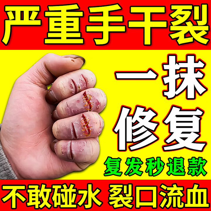 本草仁康手裂愈合膏手足皮肤干燥皲裂膏防裂手足干裂严重皲裂手指开裂粗糙 1盒 裂手裂脚裂角专用修复膏【图片 价格 品牌 报价】-京东