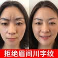 OIMG川字纹贴膜淡化眉间川字纹额头纹贴提拉紧致抬头纹川字纹去除神器 川字纹贴（买一送一）到手两盒