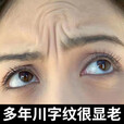OIMG川字纹贴膜淡化眉间川字纹额头纹贴提拉紧致抬头纹川字纹去除神器 川字纹贴（买一送一）到手两盒