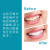 Regenerate 美白固齿保护牙釉质牙膏75ml+14ml/套 清新口气