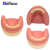 TWTCKYUS上颌窦提升操练模型 种植牙练习模型 口腔种植 软牙龈 齿科材料 上颌缺失牙种植模型B款 1个