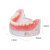 SPEEDWATTX 牙齿模型 口腔教学牙齿摆件 病理牙蛀牙龋齿教具 牙齿解剖模型 4颗钉半口种植模型