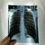 胶片喷墨蓝片干式CT DR CR 牙科X光片放射科打印胶片 特殊规格定制