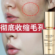 【法国仙婷祛痘精华】收缩毛孔精华液乳糖酸亮肤改善痘痘闭口粉刺黑头保湿细致毛孔补水淡化痘印 梦芮 一瓶 【初步改善毛孔粗大】