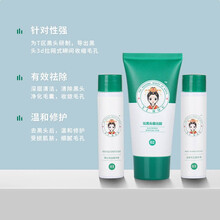 去黑头鼻贴黑头导出液祛黑头套装鼻贴黑头贴收缩毛孔粗大鼻膜男女通用医后 一套组合【温和不伤肤】