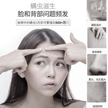 青花椒除螨喷雾去螨虫床上免洗家用除螨祛螨虫云南本草 2瓶优惠装