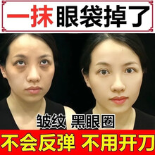 胶原蛋白眼膜贴淡化细纹淡化黑眼圈眼袋脂肪粒补水保湿紧致抗皱缓解眼疲劳敏感肌可用眼膜男女抖音同款倾姿堂 4盒20对眼膜+6片42粒胶囊眼霜