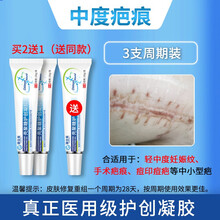 疤痕膏去疤修复凝胶贝连娜那处疤膏笆克祛疤膏 3盒