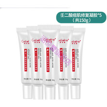 百分之15%  壬二酸  祛痘膏  淡痘印修复痘坑痘疤除青春痘学生凝胶 壬二酸痘肌修复凝胶5支(共150g
