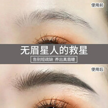 【无效可退】【送刷子】眉毛增长液男女士通用生眉液浓密快速生长眉毛营养液睫毛增长液眉毛生长眉睫通用 三瓶装（巩固长度，长效呵护）