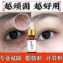 【南方协和】新款草本祛眼部脂肪粒油脂粒汗管瘤眼霜膏男女通用淡化黑眼圈眼袋眼部细纹 1盒【试用装】建议选择疗程装