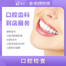 可月 缀美口腔 【口腔检查】牙痛/牙龈出血/智齿检查 科检查 牙周组织全面分析 口腔全口检查