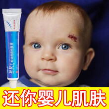 疤痕一抹消去疤痕倍舒痕祛疤膏去疤痕修复无痕美过疤克祛疤腿部 新客试用【淡疤无痕】