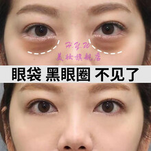 肌皙源红蛇毒眼膜淡化黑眼圈皱纹紧致抗皱西班牙进口类蛇毒肽胶原眼膜30对 红蛇毒眼膜2盒60对特惠装