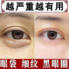 蛇毒眼膜去眼袋贴眼贴膜淡化细纹去黑眼圈消除皱纹紧致抗皱眼纹保湿补水男女士通用慕漾 一盒装轻度装（60片装）