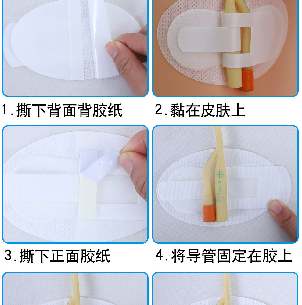 真情護理醫用導管固定貼體表導管固定裝置導尿管固定貼醫用導管固定